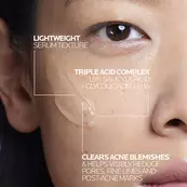 Effaclar Salicylic Acid Acne Treatment Serum