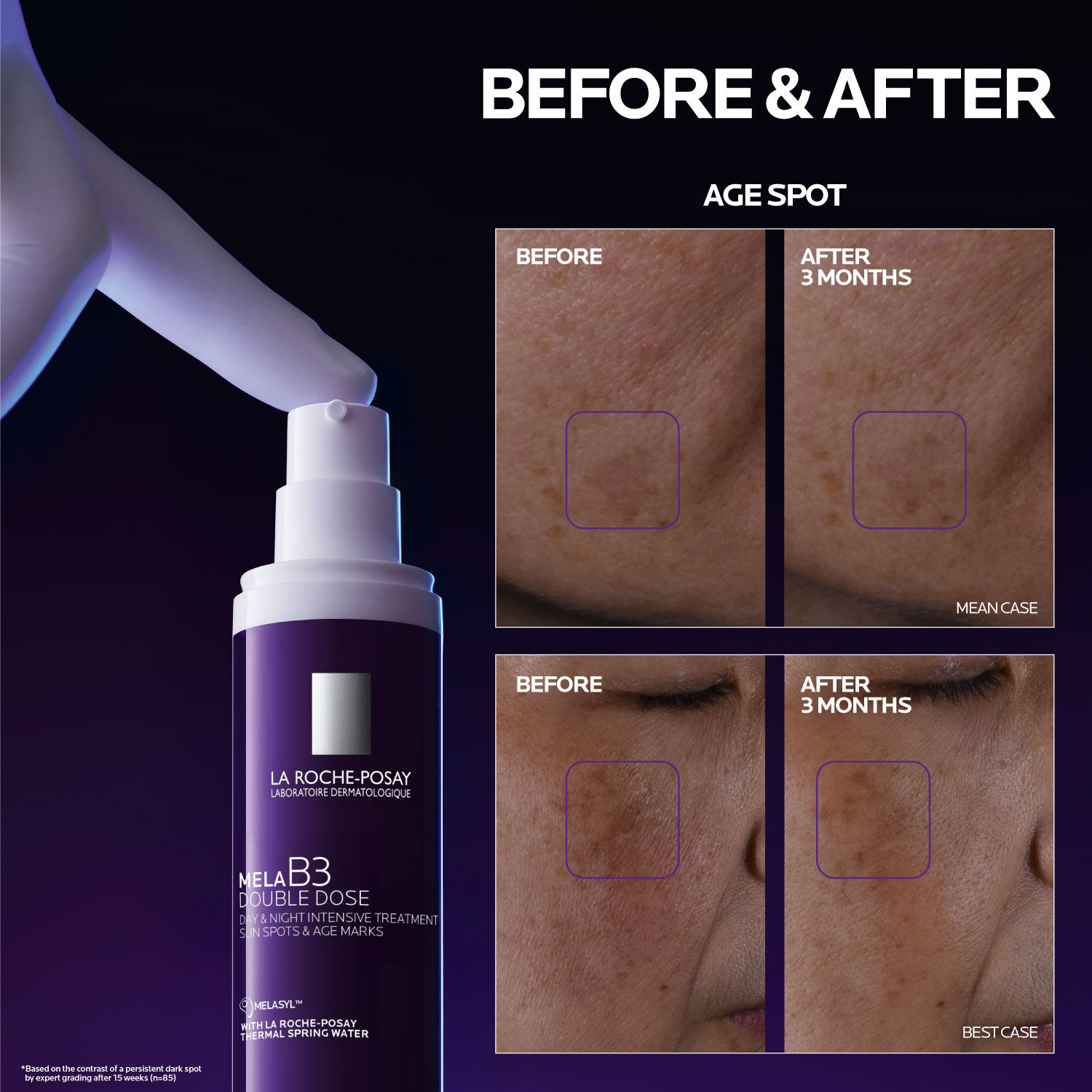 Mela B3 Double Dose Discoloration Treatment with Melasyl™