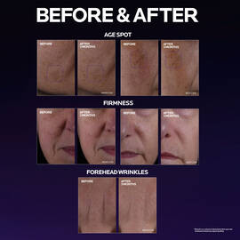 Mela B3 Double Dose Discoloration Treatment with Melasyl™