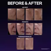 Mela B3 Double Dose Discoloration Treatment with Melasyl™