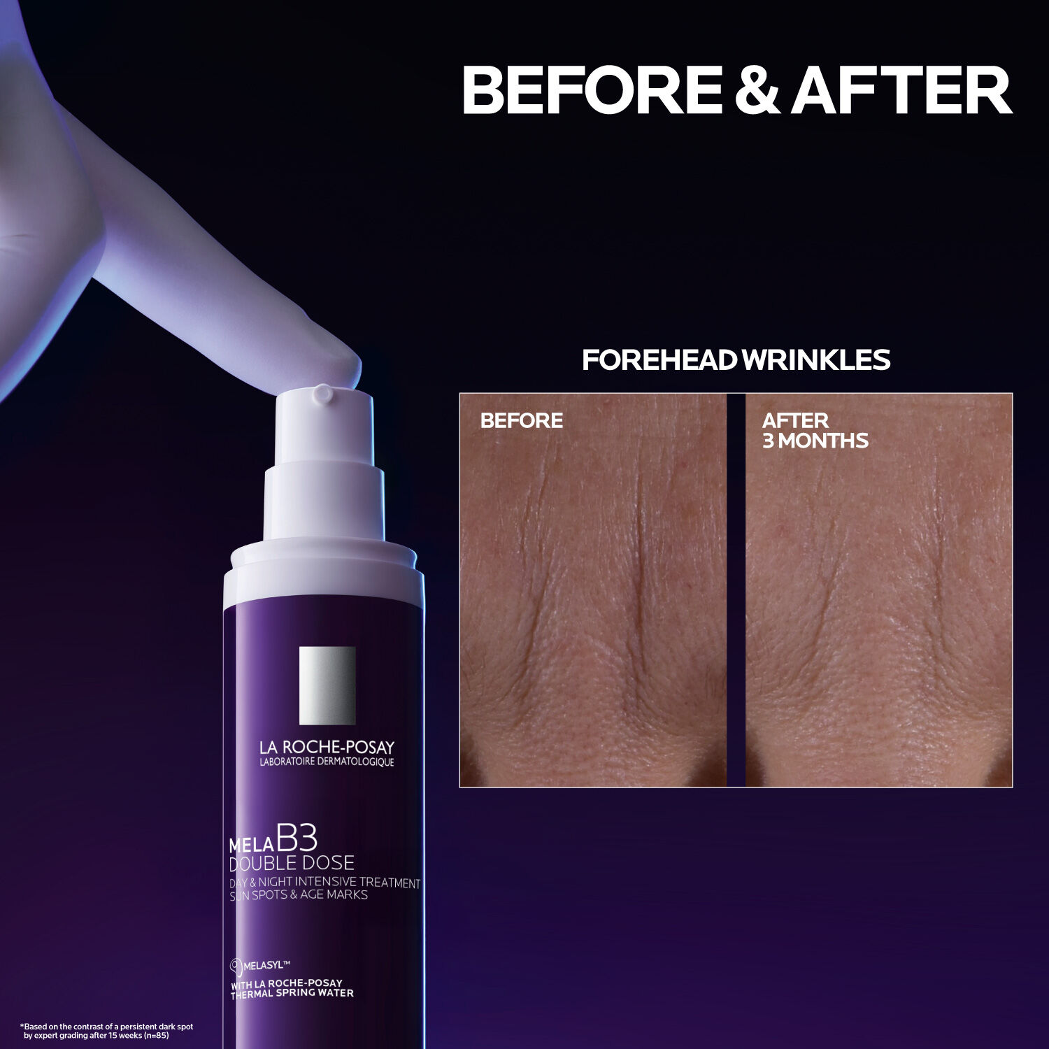 Mela B3 Double Dose Discoloration Treatment with Melasyl™