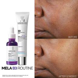 Mela B3 Dark Spot Serum & Mela B3 UV Daily Moisturizer With SPF 30