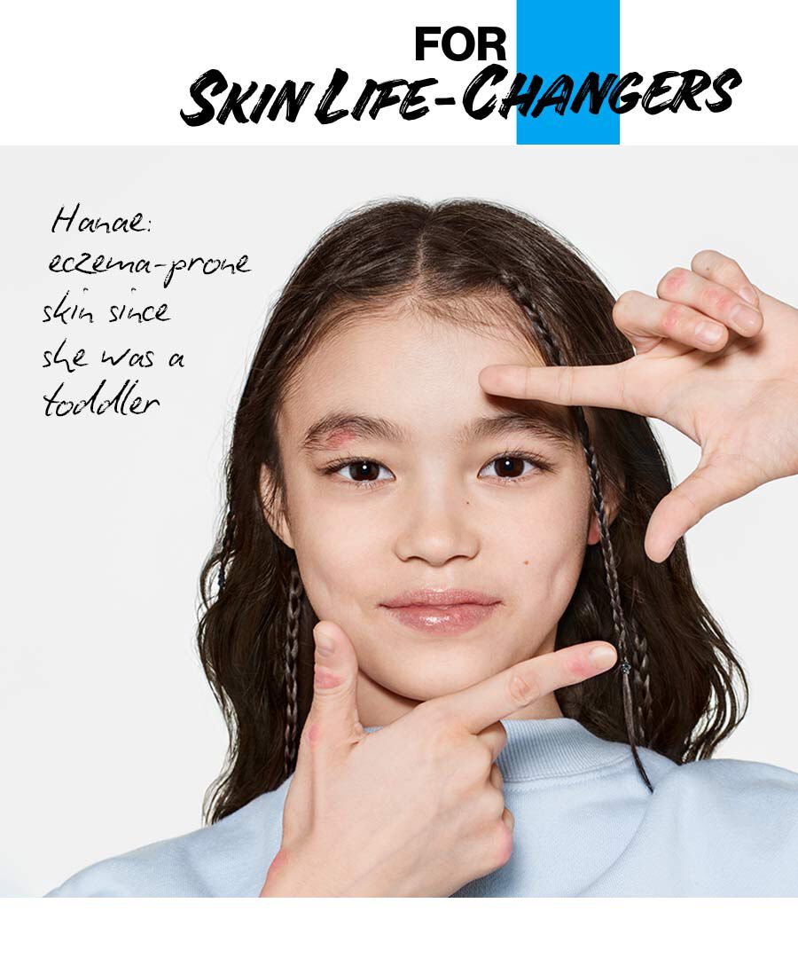 Hanae: eczema-prone skin since she was a toddler