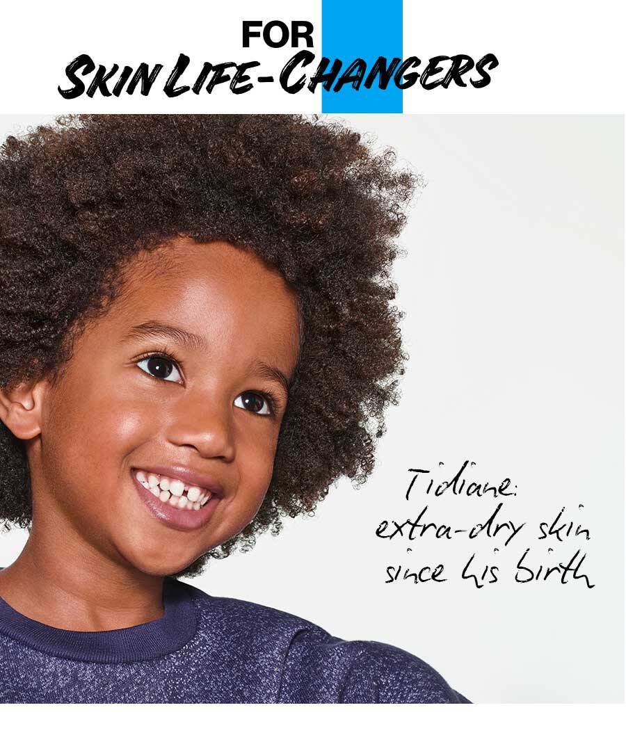 Tidiane: extra-dry skin since his birth