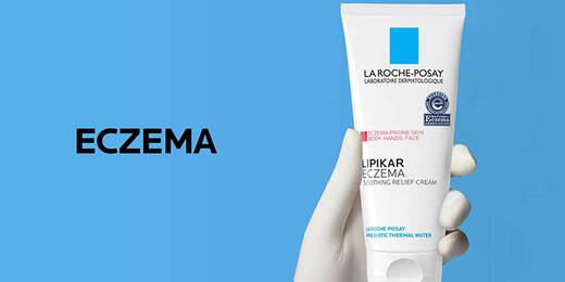 Eczema