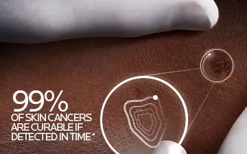 99% of skin cancers are curable if detected in time*