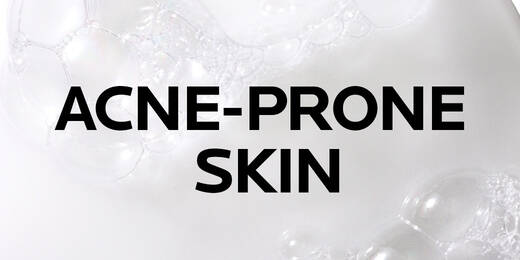 Acne Prone Skin