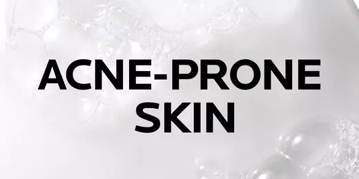 Acne Prone Skin