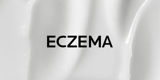 Eczema