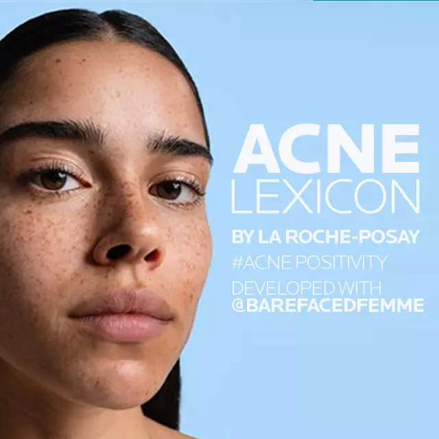 ACNE LEXICON