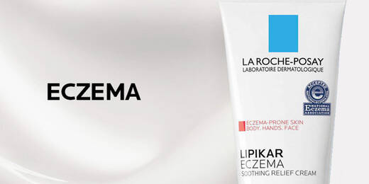 Eczema