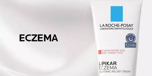 Eczema